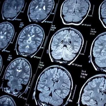 Google and Osaka University's Groundbreaking Research Turning Brain Scans into Music with AI